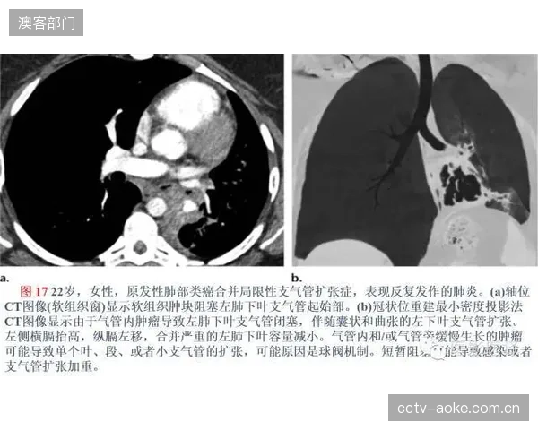 颗粒度战争:运动损伤预防的战场已从关节活动度转向单束肌肉纤维的动态追踪 颗粒度战争:运动损伤预防的战场已从关节活动度转向单束肌肉纤维的动态追踪